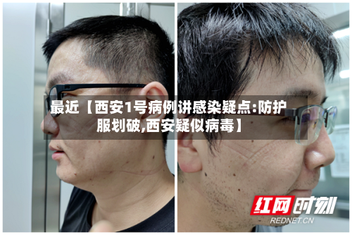 最近【西安1号病例讲感染疑点:防护服划破,西安疑似病毒】-第3张图片