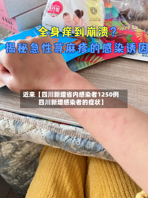 近来【四川新增省内感染者1250例四川新增感染者的症状】