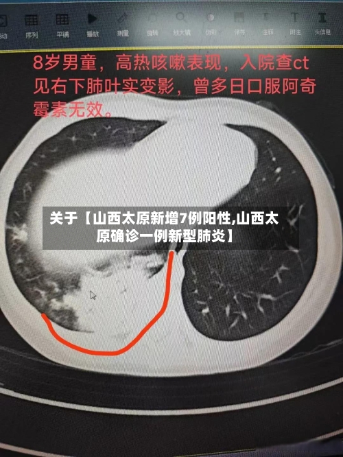 关于【山西太原新增7例阳性,山西太原确诊一例新型肺炎】-第3张图片