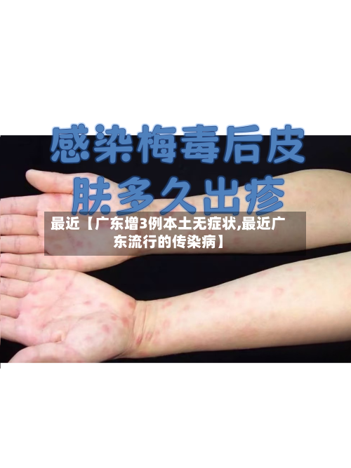 最近【广东增3例本土无症状,最近广东流行的传染病】