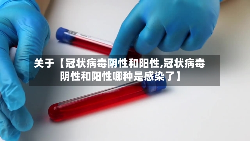 关于【冠状病毒阴性和阳性,冠状病毒阴性和阳性哪种是感染了】